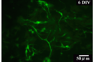 ニューロン（神経細胞特異タンパク質：MAP2の染色蛍光像）