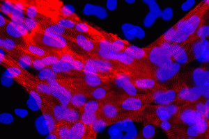 心筋細胞（アクチン：アクチニンと核：ヘキストの染色蛍光像）